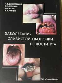 Навчальний посібник Захворювання слизової оболонки порожнини рота