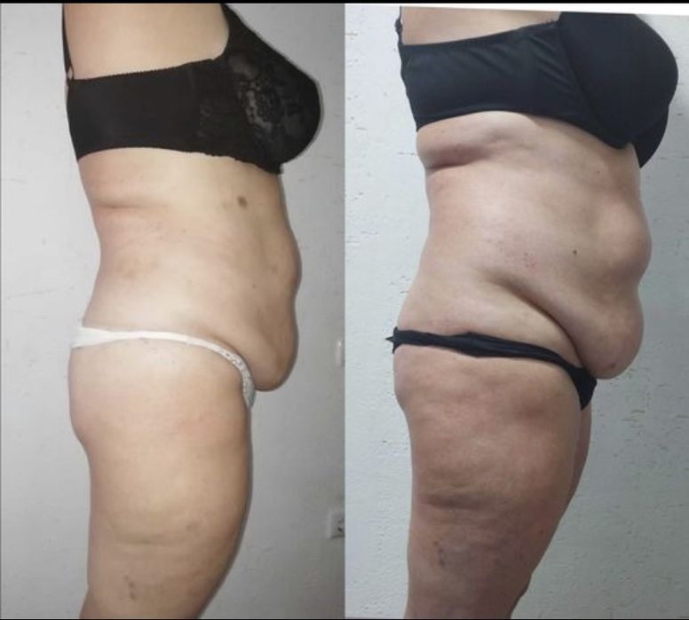 Корекція тіла. Масаж. Обгортування