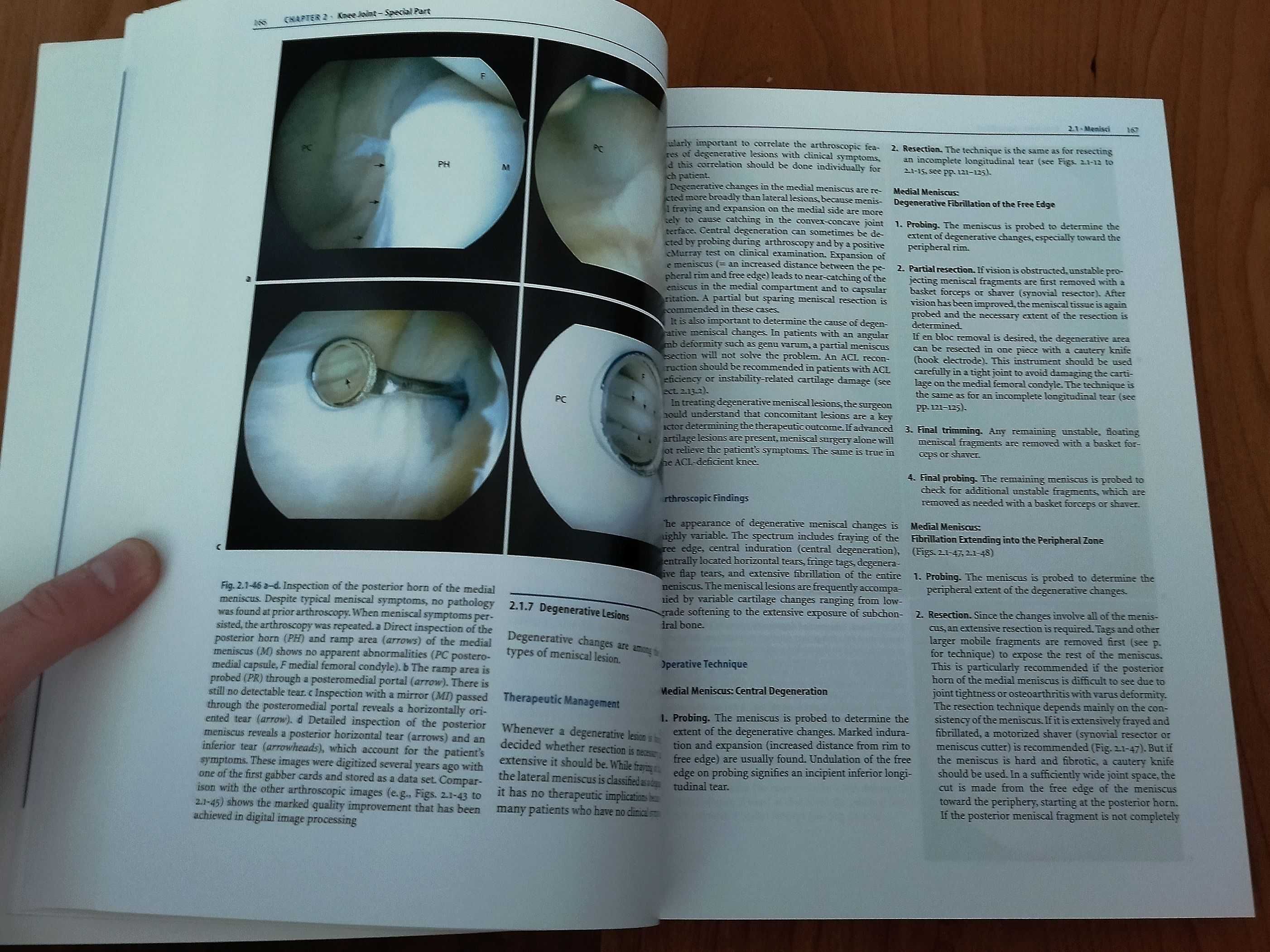 Manual of Arthoscopic Surgery - Michael J. Strobel - ortopedia