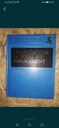 Complications of total hip replacement kolekcjonerska PRL