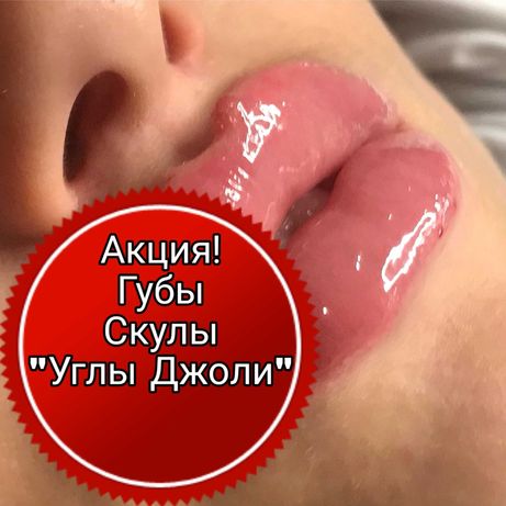 Увеличение губ, биоревитализация, мезотерапия, ботокс, косметолог Киев