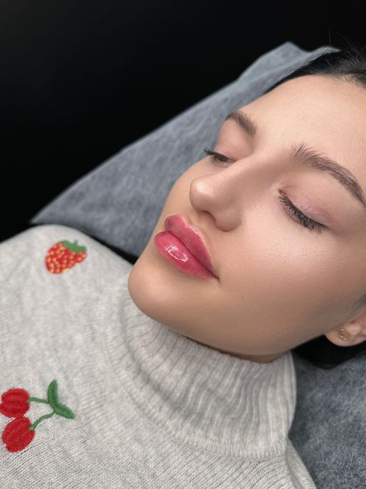 Збільшення губ та контурна пластика