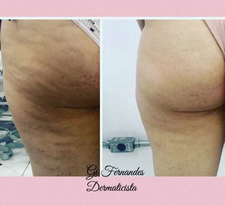 Estética Facial e Corporal Avançada/ EXCLUSIVO para MULHERES