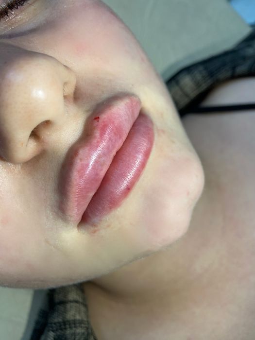 Аугментація обличчя