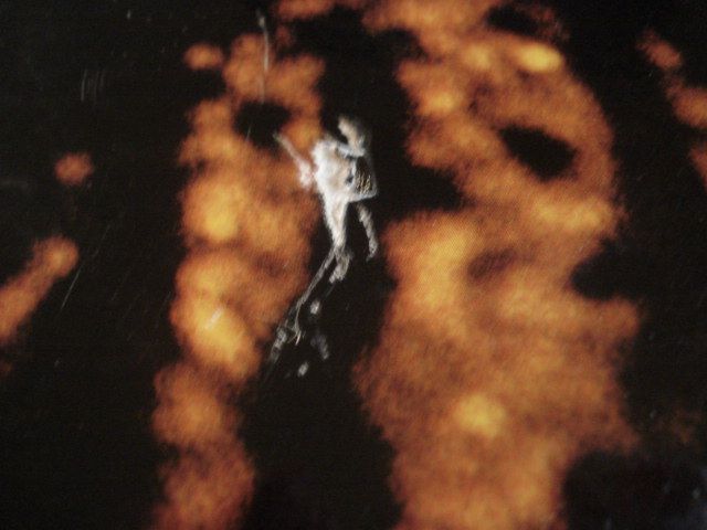 Vinil LP Ruth Brown - Black is Brown and Brown is Beautiful - Raro