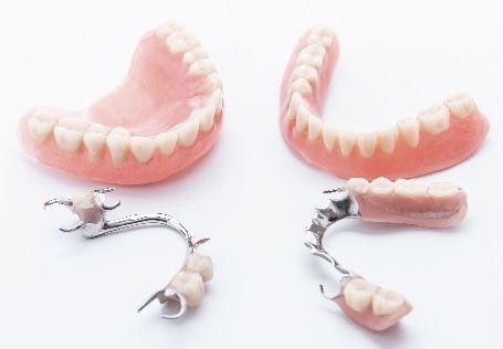 Инжекция Починка зубных протезов, Vertex Acron и Acetal