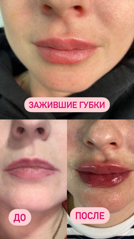 Косметолог Центр Днепр Акционные предложения