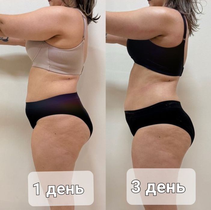 Професійний дієвий масаж на дому.