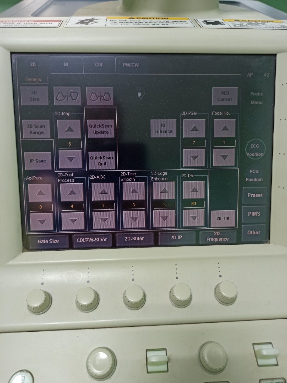 УЗД експертного класу Toshiba Aplio XG.