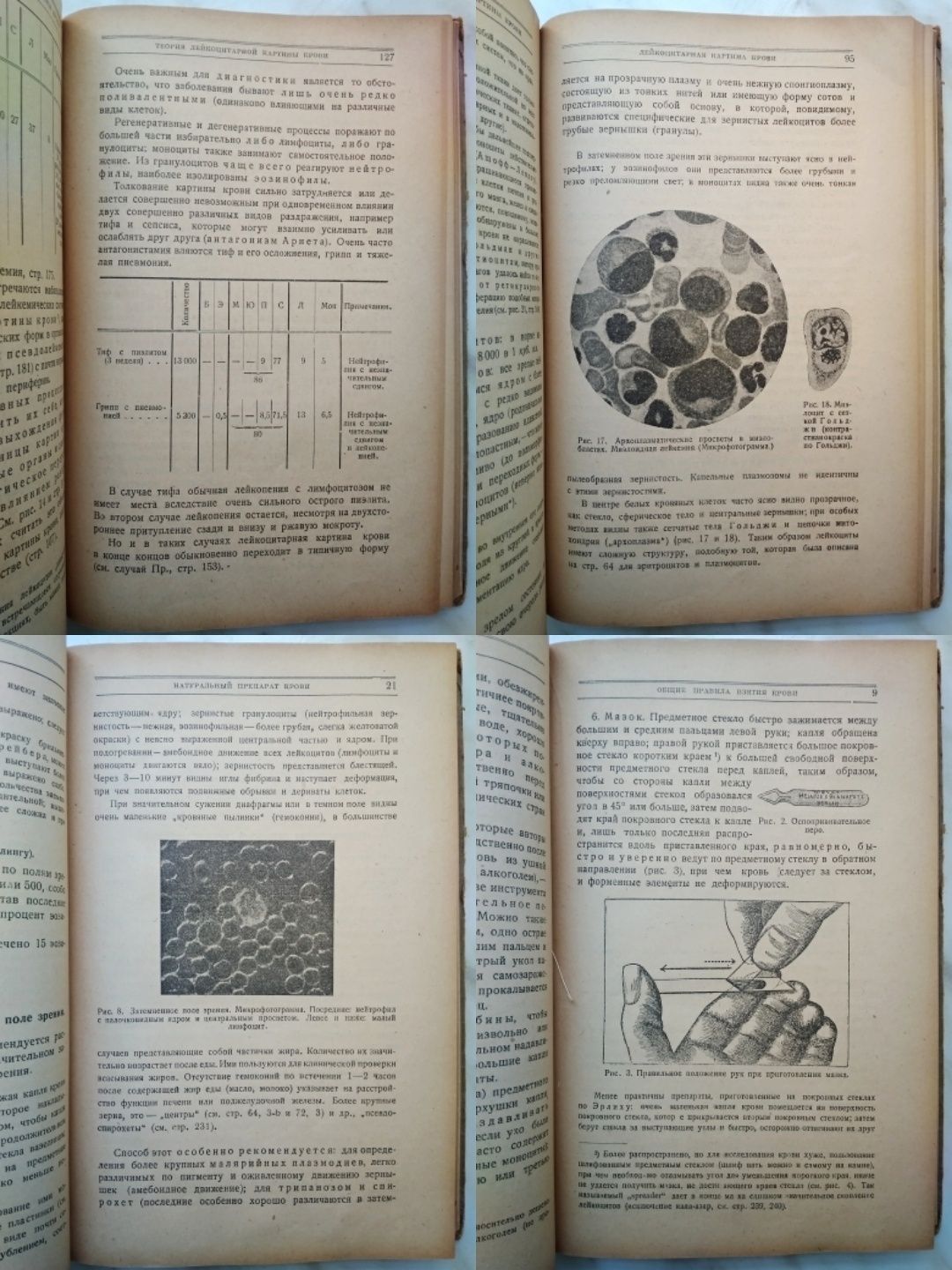 "1926 г! Картина крови и её клиническое значение. В. Шиллинг"