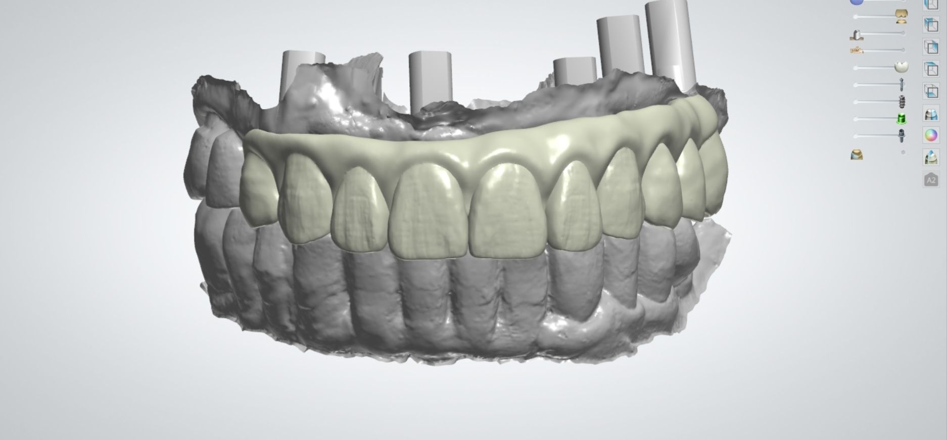 Protezy zębowe modelowanie 3shape technik dentystyczny