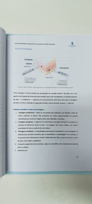 Manual de remoção de tatuagens a laser e Peeling de Hollywood