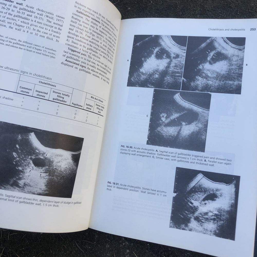 Ultrasound Diagnosis Of Digestive Diseases Francis S. Weill 1982