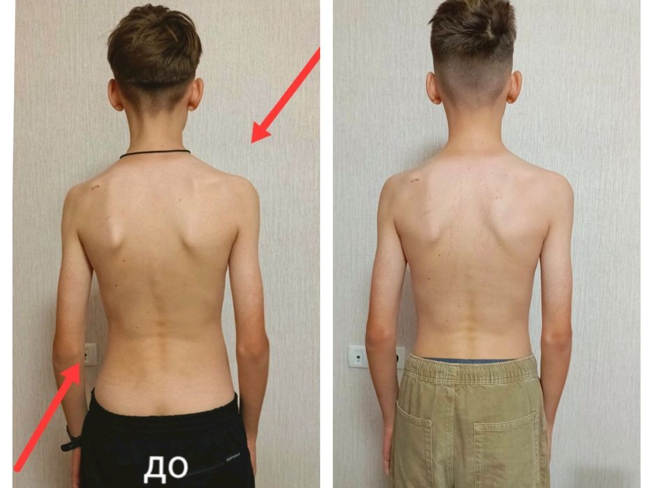 Остеопат, лечение мышечной боли.