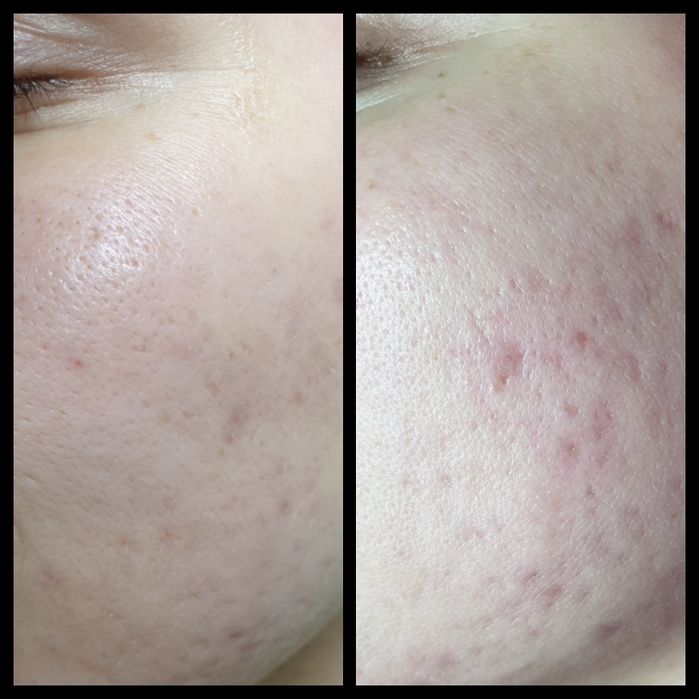 Косметолог- эстетист ,Теремки ,Голосеевский р-н. Выезд на дом .