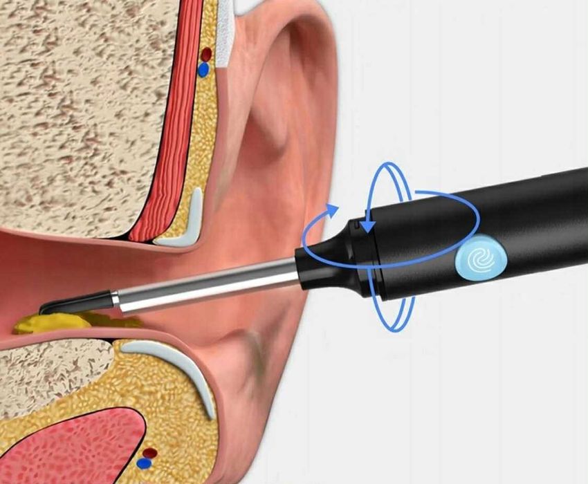 Kamerka hd do CZYSZCZENIA uszu nosa obserwacji laryngolog w domu! hit!