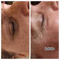 Masaż kobido lifting twarzy, masaże relaksacyjne, lecznicze