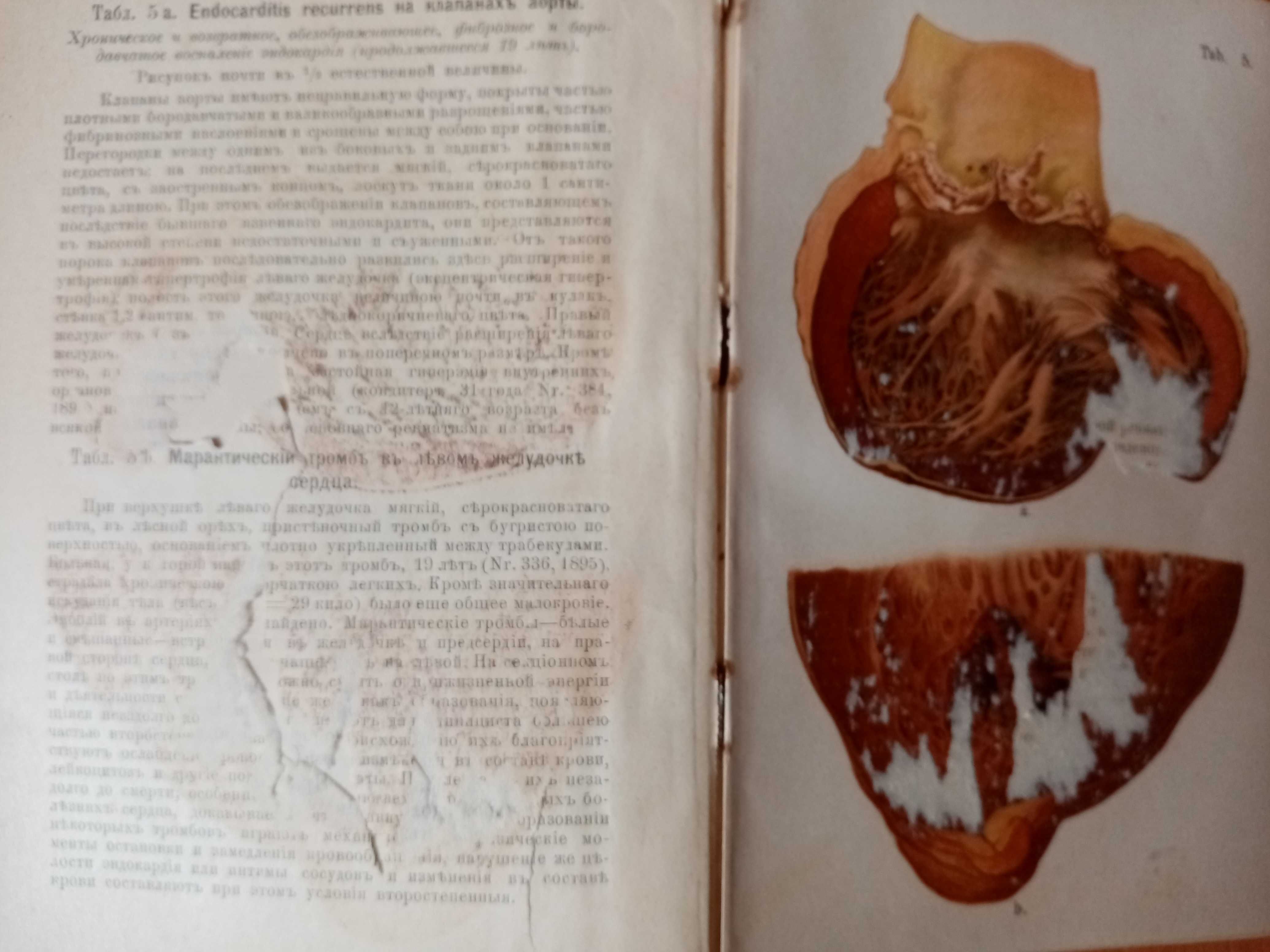 Том 5. Атлас и краткие основы патологической анатомии. Часть 1. 1897г.