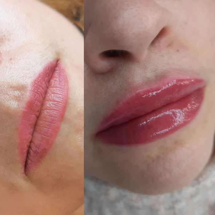 Косметолог, массаж, контурная пластика, мезотерапия, ботулинотерапия