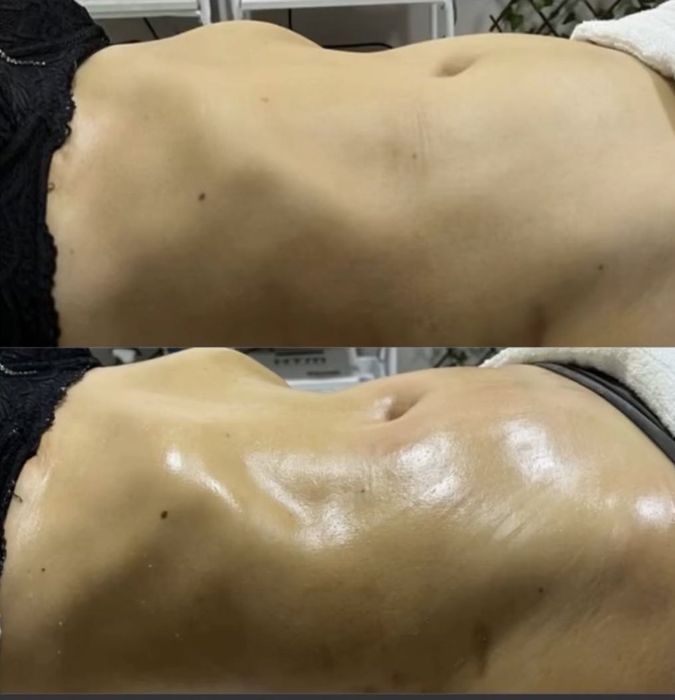 Massagem corporal Redutora