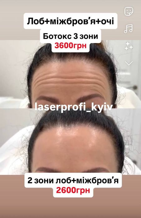 Косметолог Харківський рн.метро Вирлиця