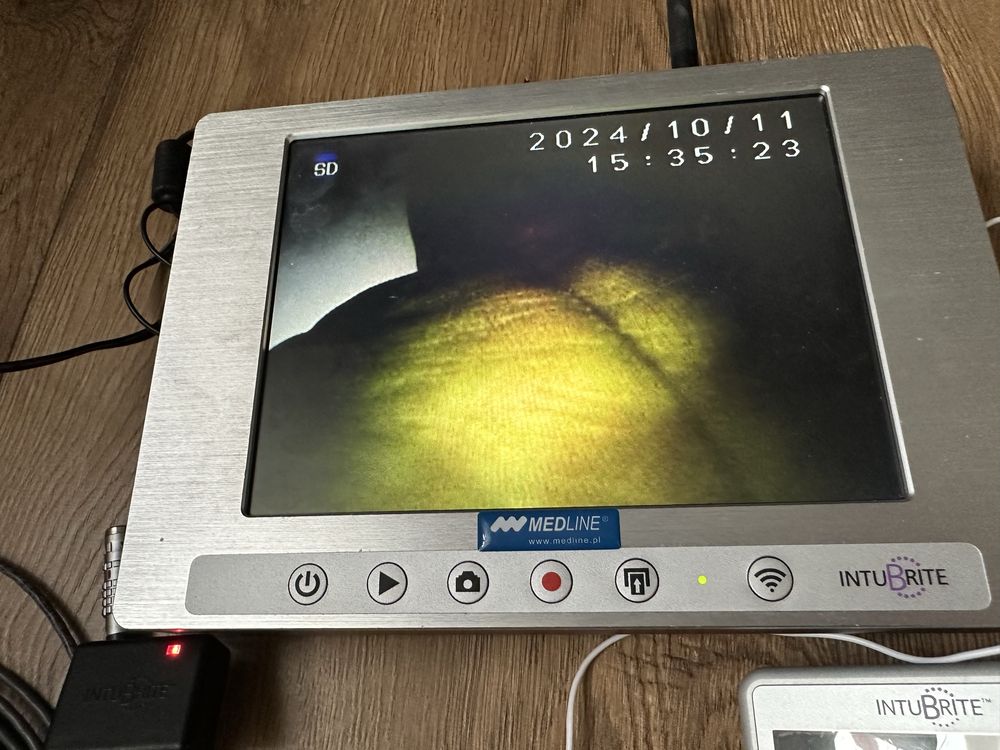 Video laryngoskop wifi