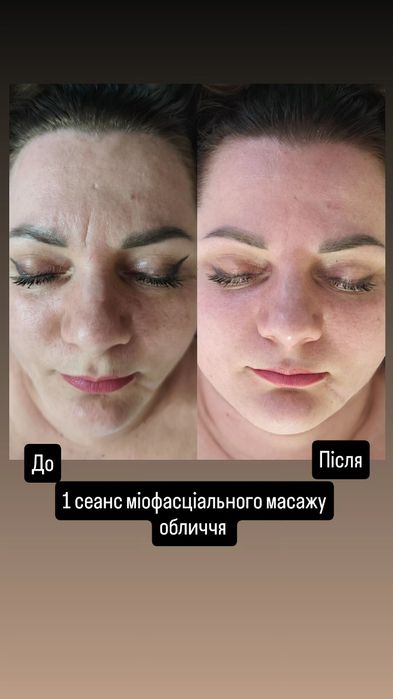 Навчання з масажу