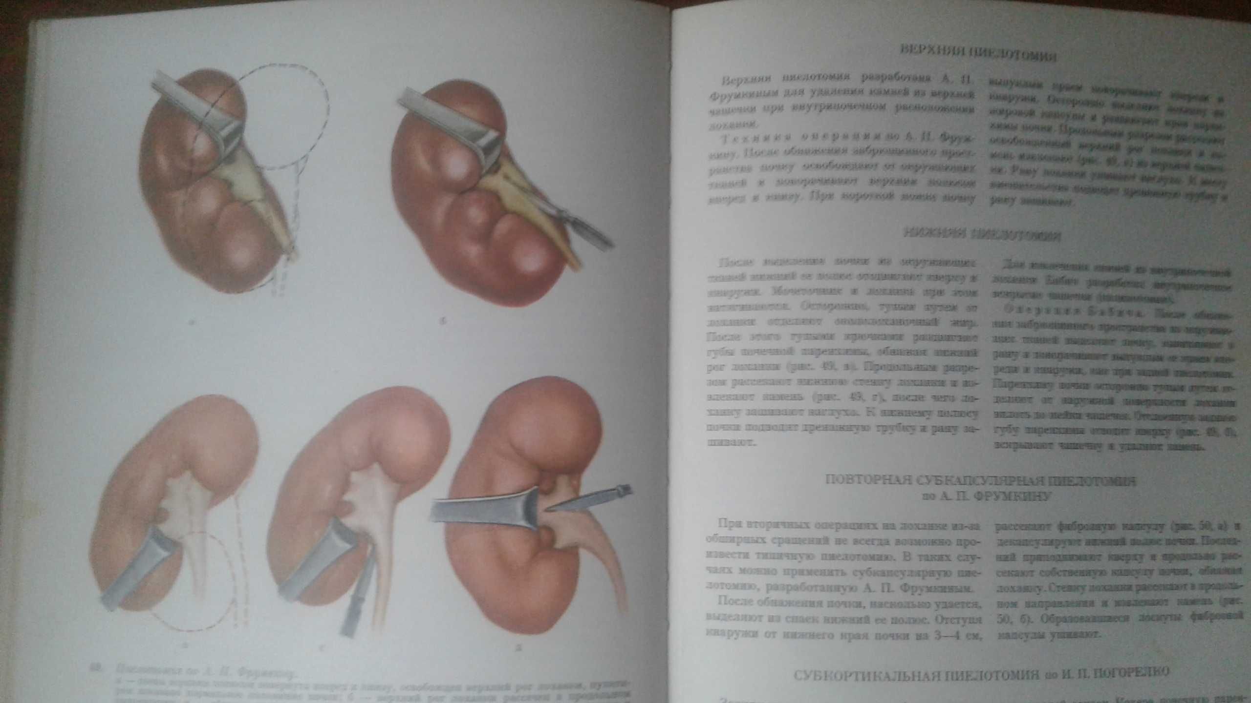 Атлас операций на органах мочеполовой системы