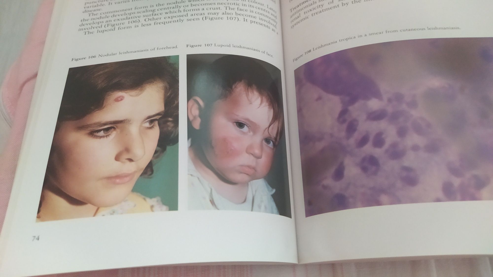 Atlas dermatologiczny pediatria An atlas of pediatric dermatology