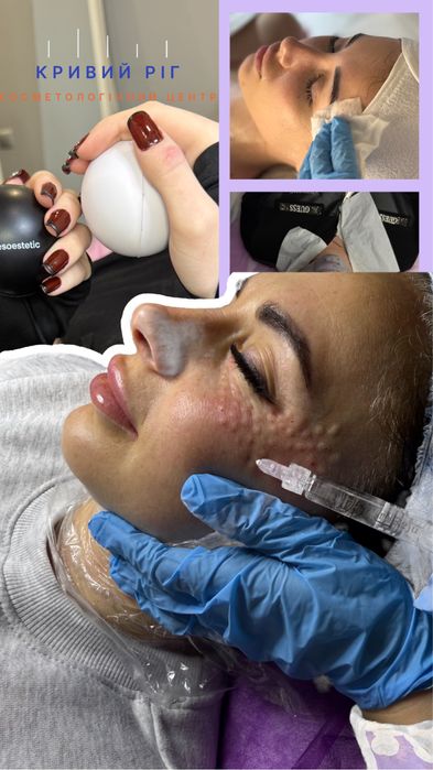 Косметолог кривий ріг чистка обличчя ботокс збільшення губ
