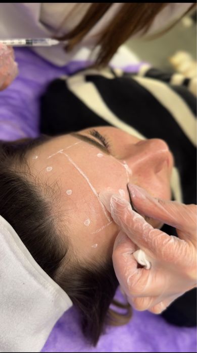 Косметолог кривий ріг чистка обличчя ботокс збільшення губ