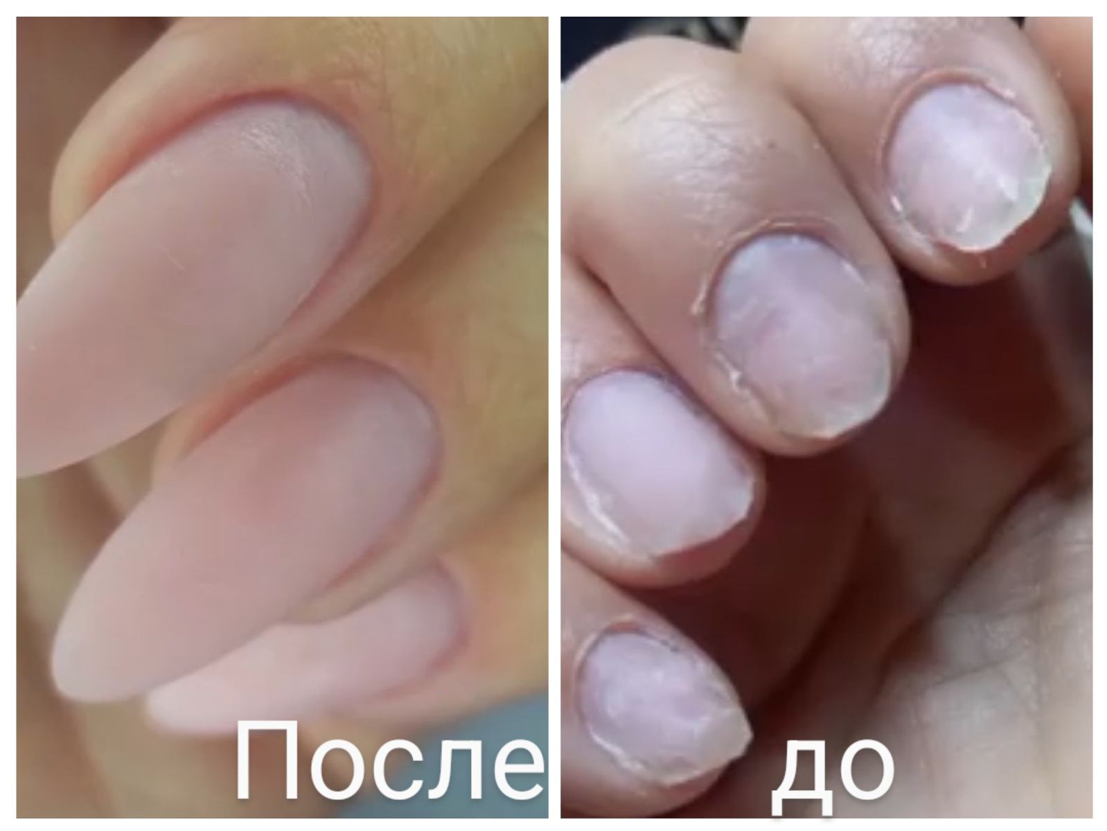 Маникюр,наращивание ногтей,проблемные ногти