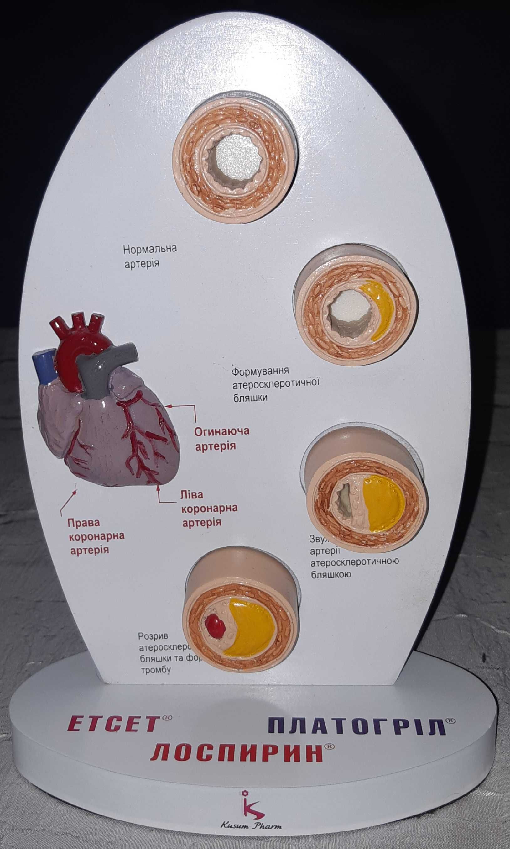 Продам "Модель атеросклероза"