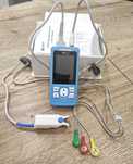 Професійний пульсоксиметр PM10 Handheld Patient Monitor