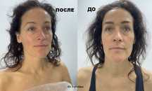 Косметолог.Печерск.Гидропилинг/Hydrofacial/Чистка лица/Пилинг/Карбокси