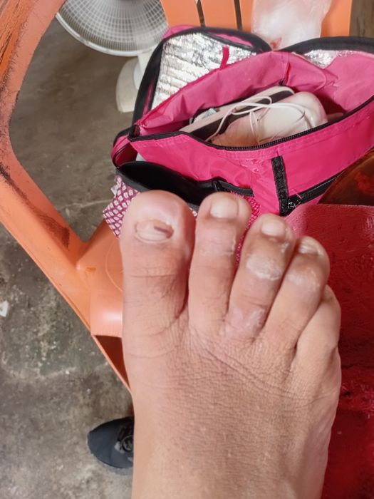 Estética de pés e mãos