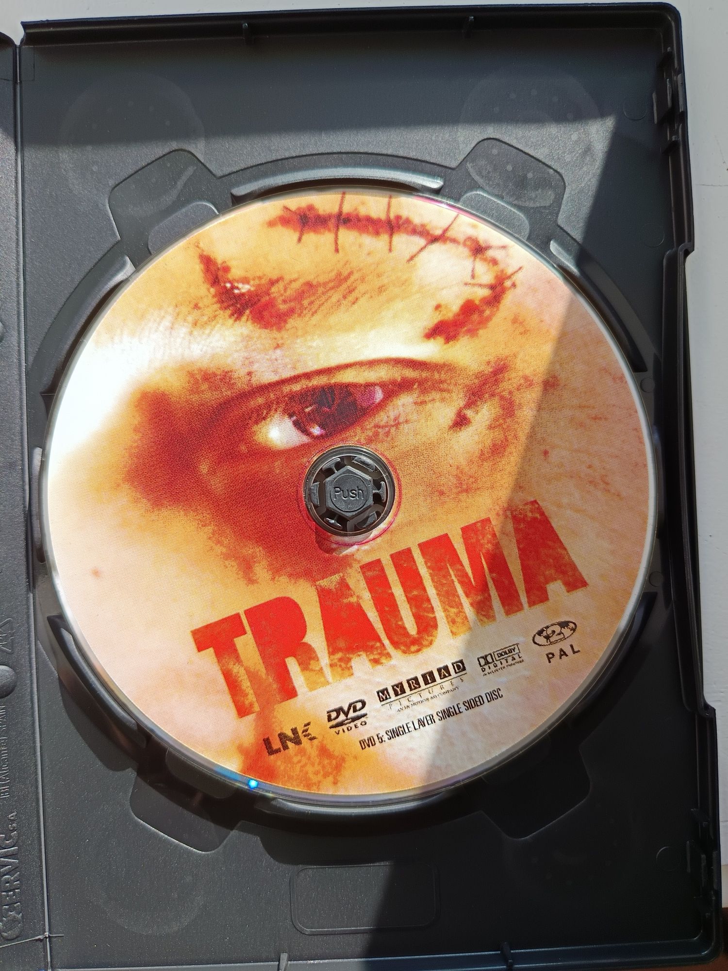 DVD trauma.       .