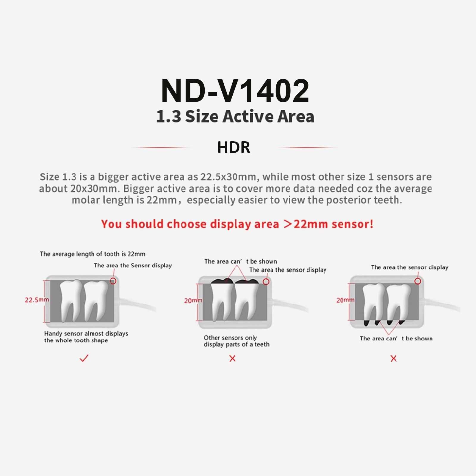 RVG Sensor HDR ND-V1402