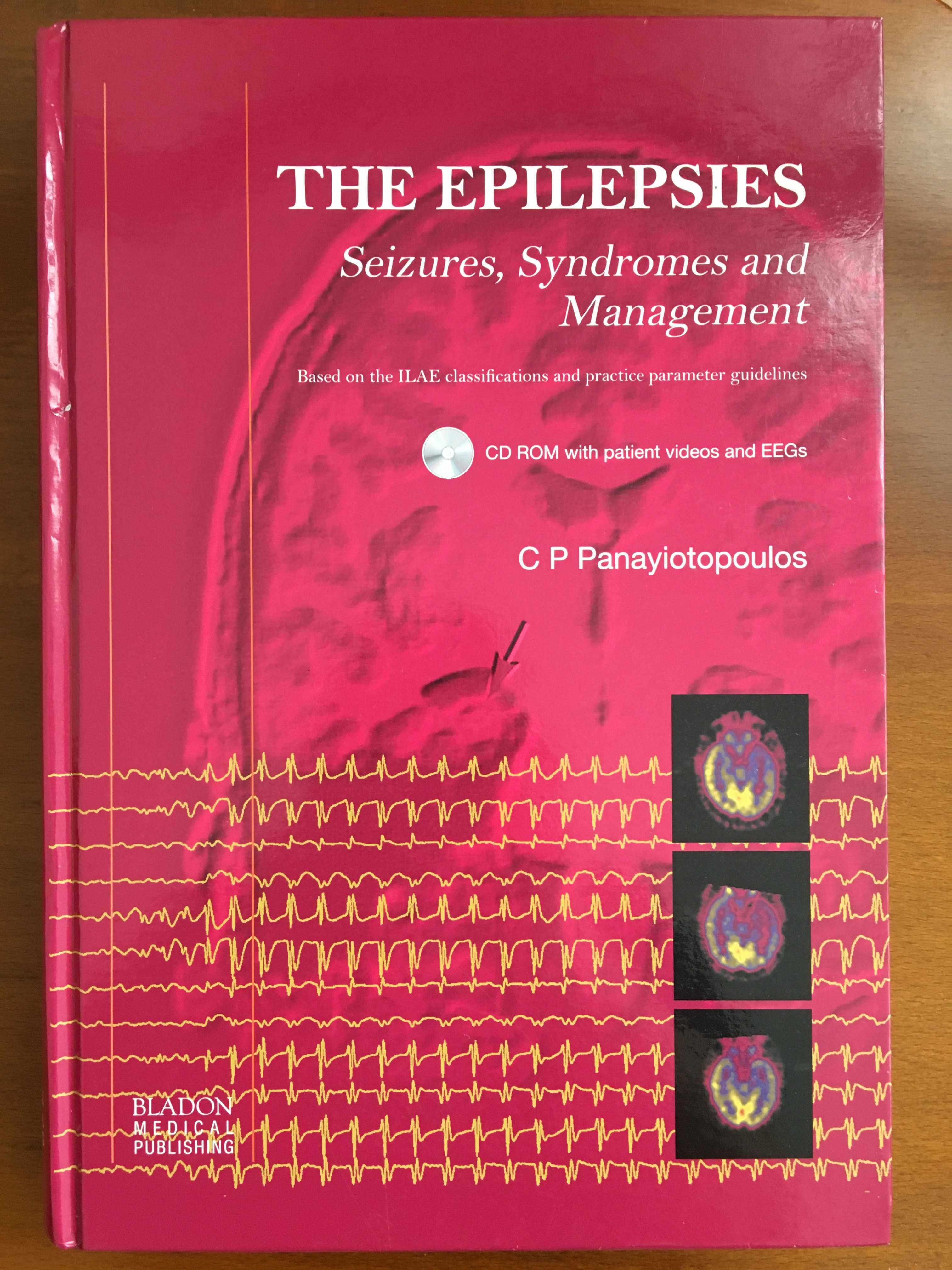 The Epilepsies: Seizures, Syndromes and Management