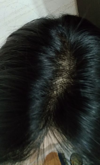 Peruka z włosów naturalnych ludzkich

Nowy bez metki