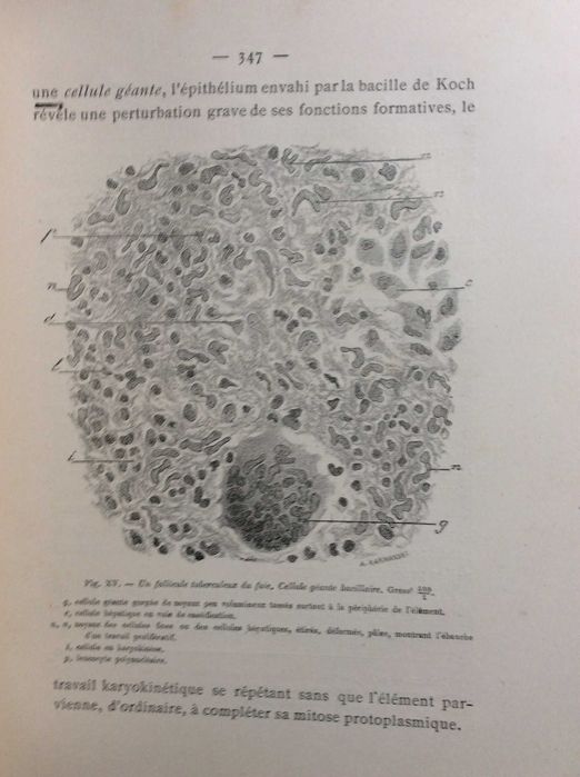 L'Inflammation. Études anatomo-pathologiques, 1893