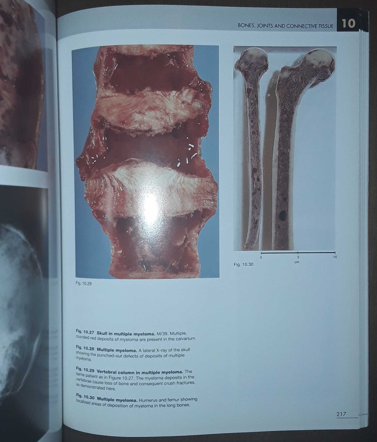 Color Atlas of Anatomical Pathology 3rd edition Cooke