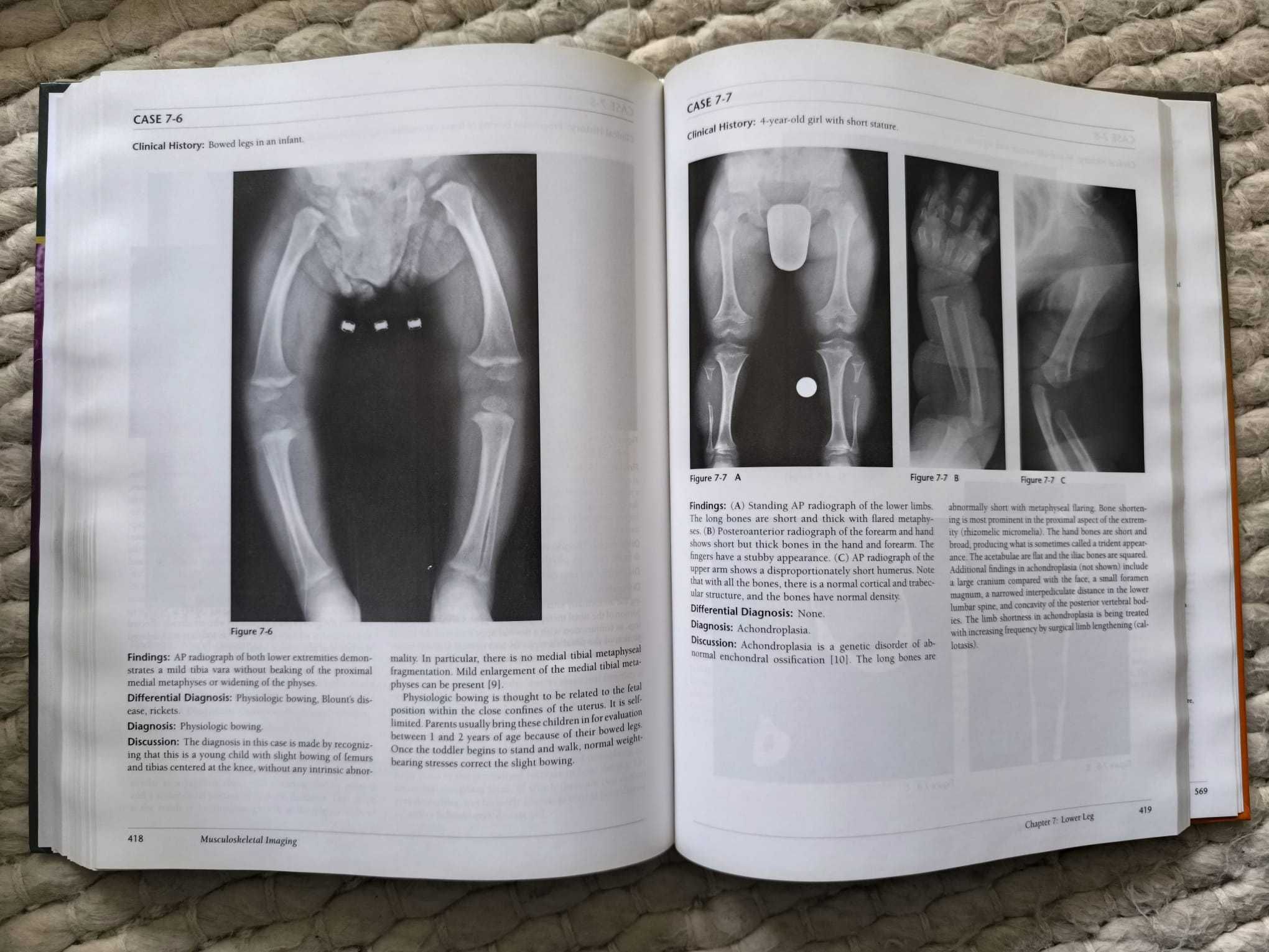 Livro "Musculoskeletal Imaging: A Teaching File" de Felix Chew