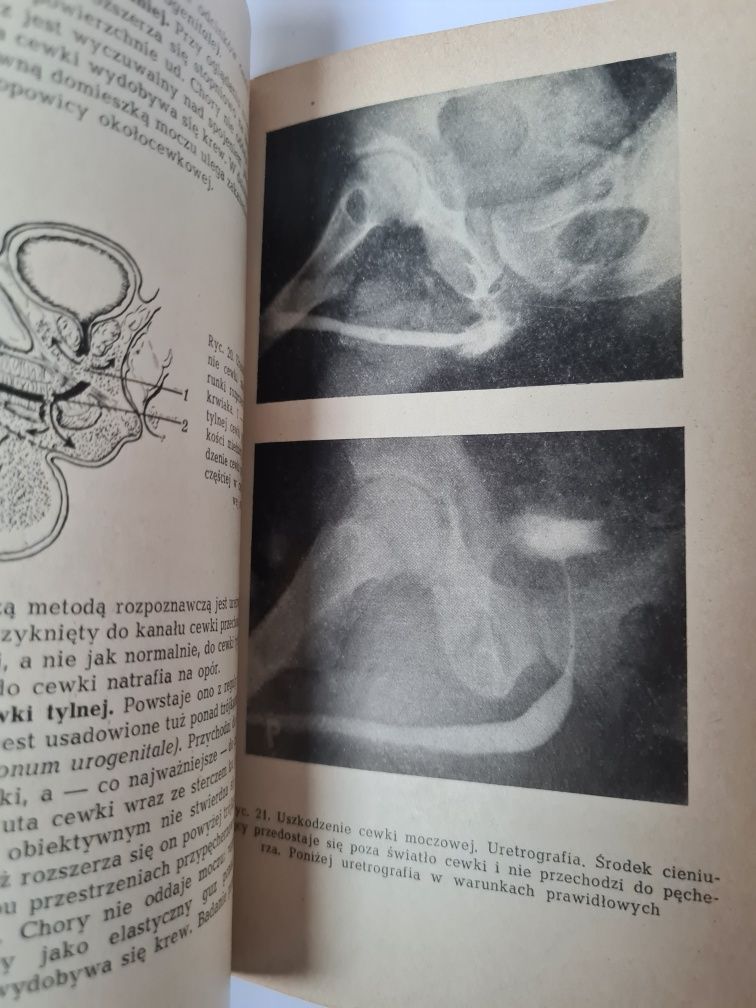 Urologia - Emil Michałowski, Wojciech Modelski. Książka