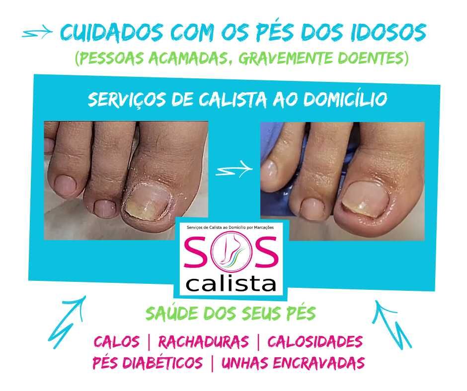 Calista ao Domicílio ou no Gabinete (Benfica)