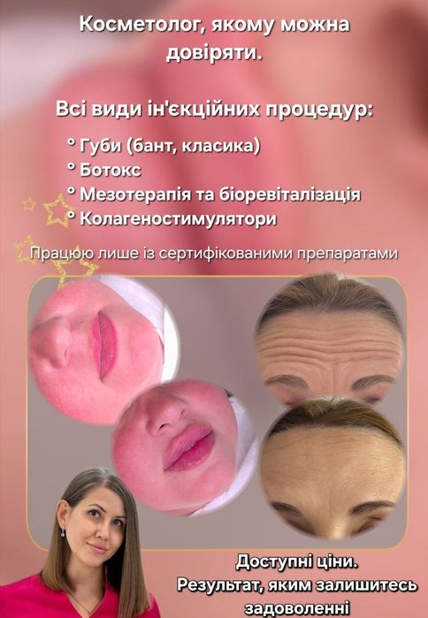 Губи за 2500 до Чорної п'ятниці