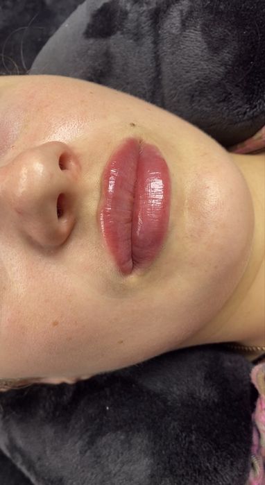 Потрібні моделі на збільшення губ