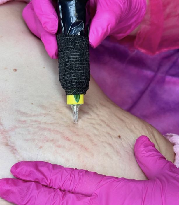 мікронідлінг з 0 до прфі курси