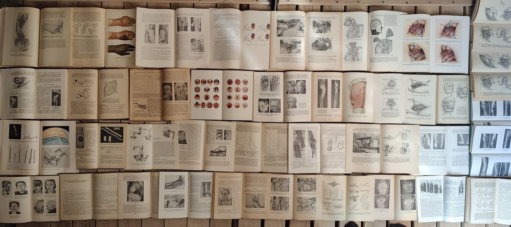 Хирургия Анатомия Пластика Трансплантация органов, тканей, конечностей