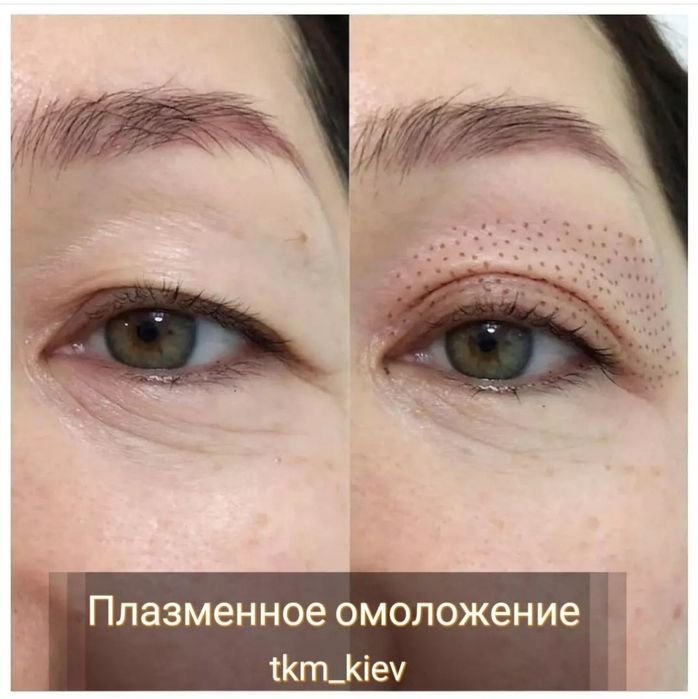 Массаж лица - 600 грн, Косметолог, Оболонь